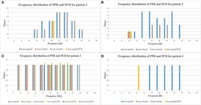 Temporal Onset Focal Seizures Induced by Intermittent Photic Stimulation